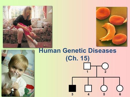 2006-2007 Human Genetic Diseases (Ch. 15) 12 3456.