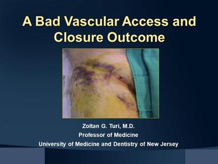 Zoltan G. Turi, M.D. Professor of Medicine University of Medicine and Dentistry of New Jersey A Bad Vascular Access and Closure Outcome.