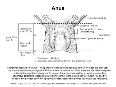 Anus Anatomic subsites of the anus. The epithelium in the peri-anal region and the vulvar zone is at risk for squamous carcinomas, along with HPV and other.