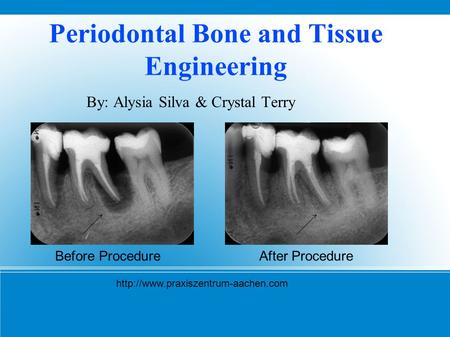 Periodontal Bone and Tissue Engineering By: Alysia Silva & Crystal Terry Before ProcedureAfter Procedure
