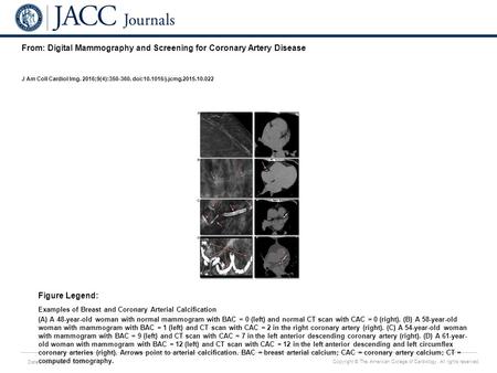 Date of download: 7/5/2016 Copyright © The American College of Cardiology. All rights reserved. From: Digital Mammography and Screening for Coronary Artery.