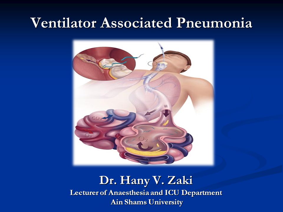 Ventilator Associated Pneumonia - ppt video online download