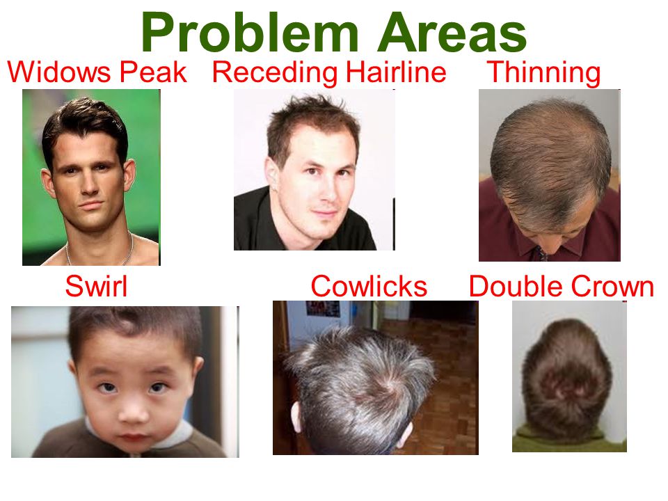 Double Crown Cowlick Hairstyles  Hair