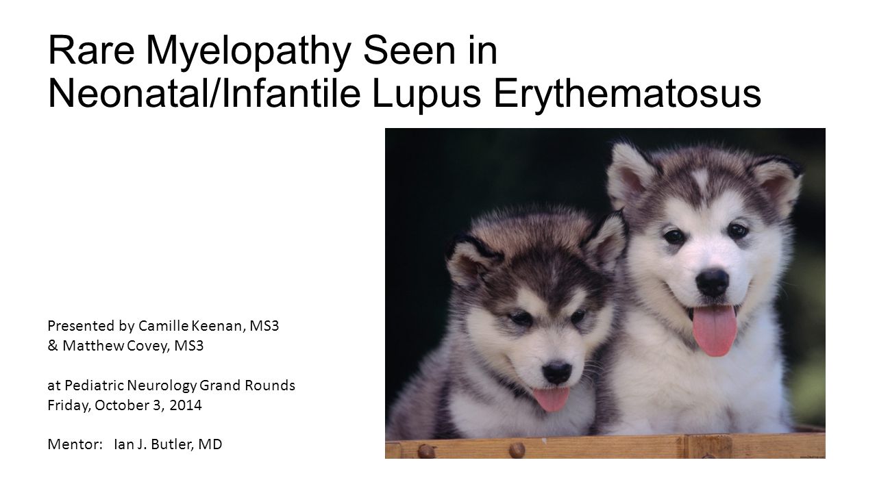 Rare Myelopathy Seen in Neonatal/Infantile Lupus Erythematosus ...