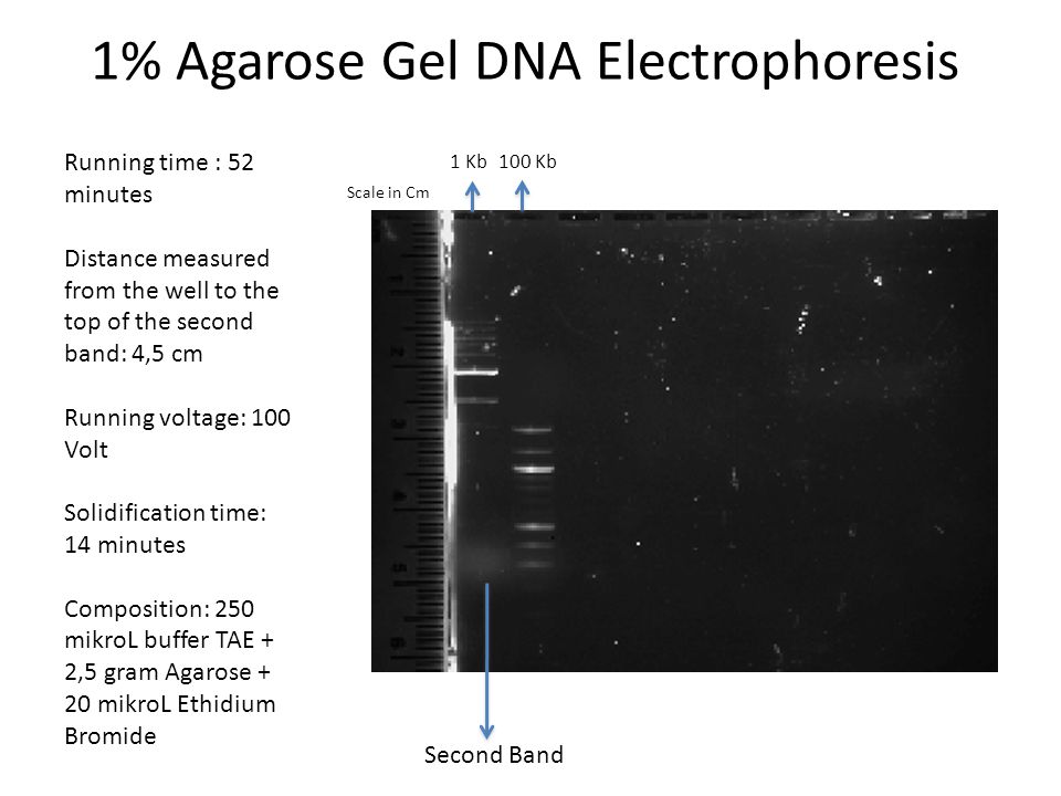 1% Agarose Gel DNA Electrophoresis Running time : 52 minutes Distance  measured from the well to the top of the second band: 4,5 cm Running voltage:  ppt download