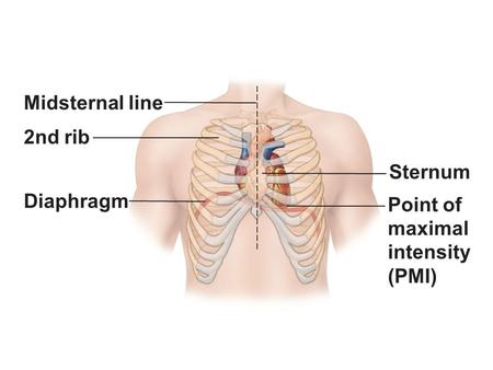 Figure 18.1a Location of the heart in the mediastinum.