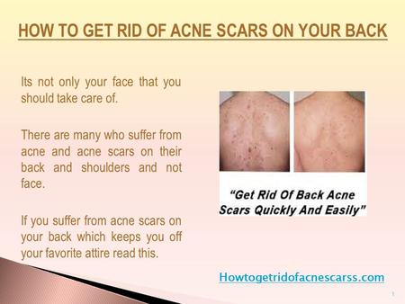 Its not only your face that you should take care of. There are many who suffer from acne and acne scars on their back and shoulders and not face. If you.