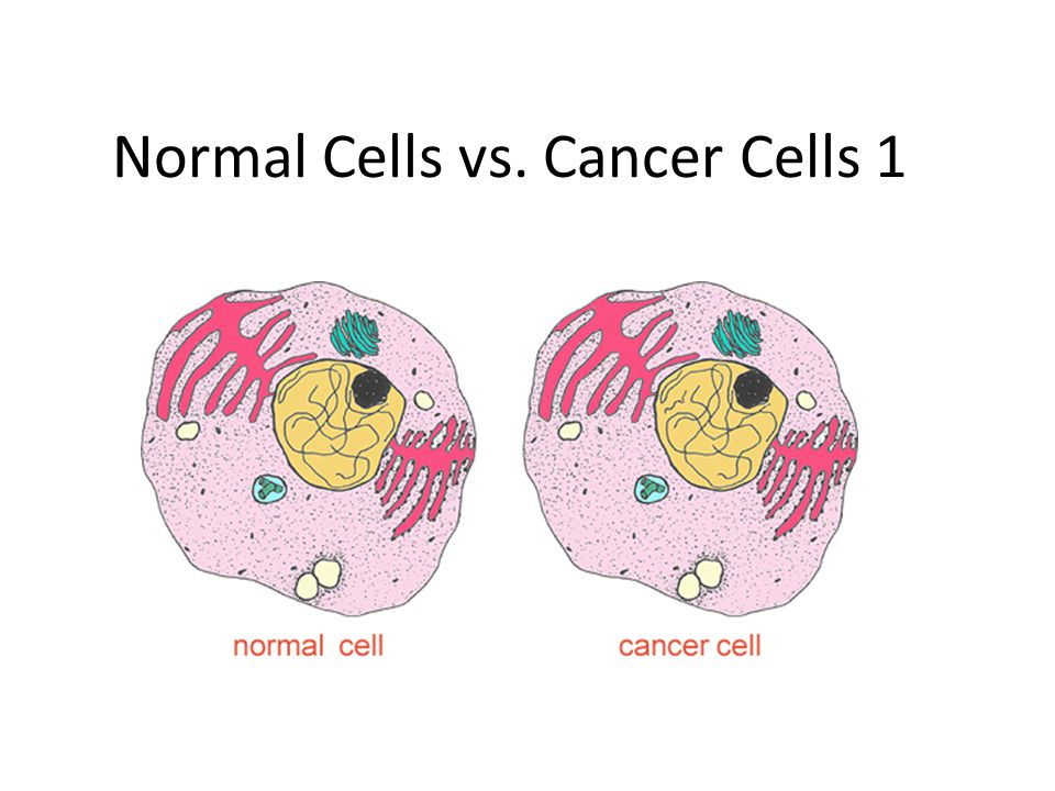 Normal Cells vs. Cancer Cells 1 - ppt video online download