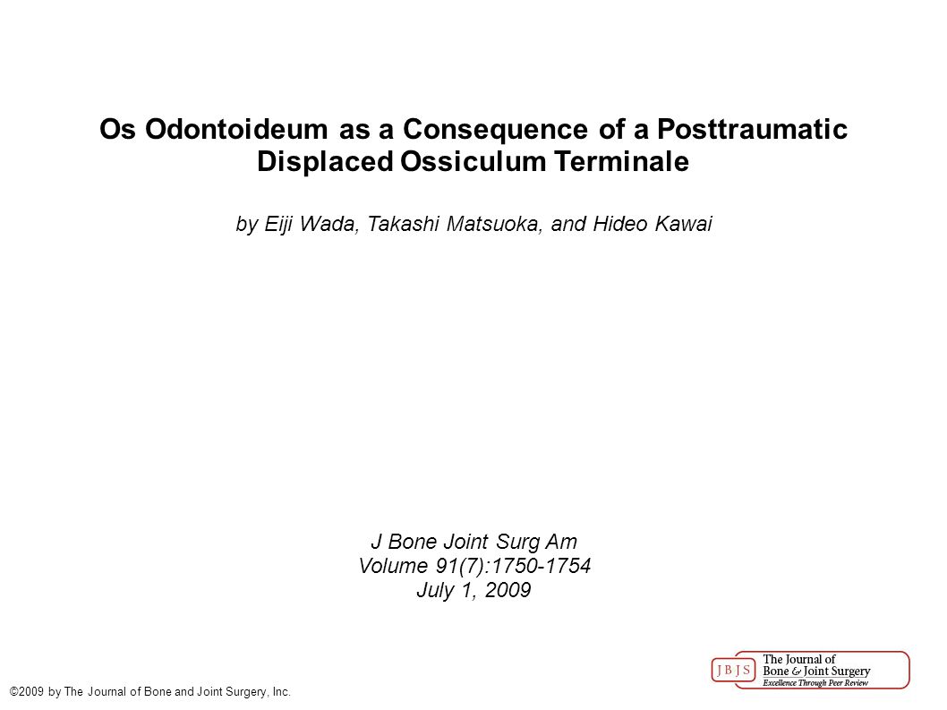 Os Odontoideum As A Consequence Of A Posttraumatic Displaced Ossiculum Terminale By Eiji Wada Takashi Matsuoka And Hideo Kawai J Bone Joint Surg Am Volume Ppt Download Os Odontoideum As A Consequence Of A Posttraumatic Displaced Ossiculum Terminale By Eiji Wada Takashi Matsuoka And Hideo Kawai J Bone Joint Surg Am Volume Ppt Download