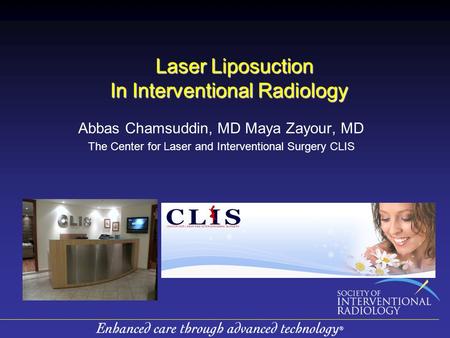 Laser Liposuction In Interventional Radiology