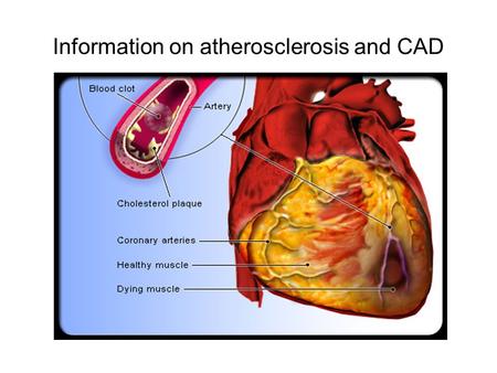 Information on atherosclerosis and CAD. How is Coronary Artery Disease Diagnosed?