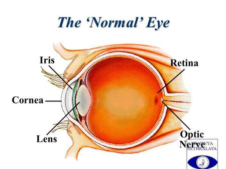 PRADNYA NETHRALAYA Lens Cornea Iris Optic Nerve Retina The Normal Eye.