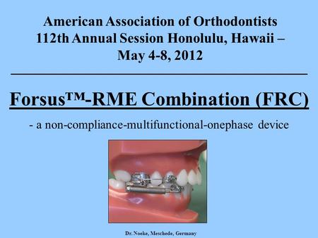 American Association of Orthodontists 112th Annual Session Honolulu, Hawaii – May 4-8, 2012 Forsus™-RME Combination (FRC) - a non-compliance-multifunctional-onephase.
