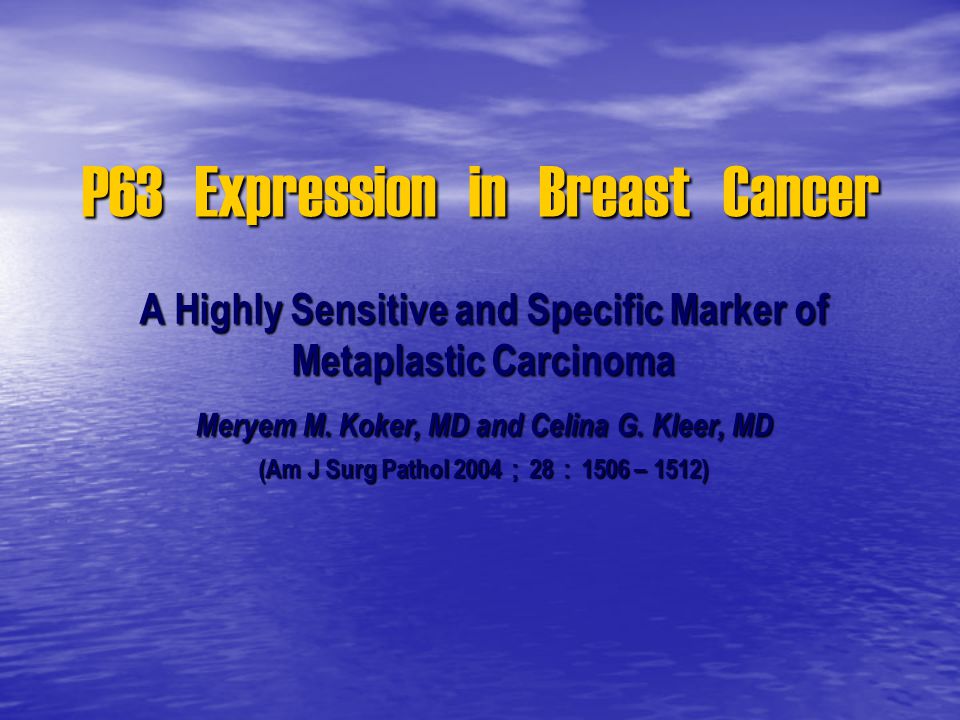 P63 Expression in Breast Cancer - ppt video online download