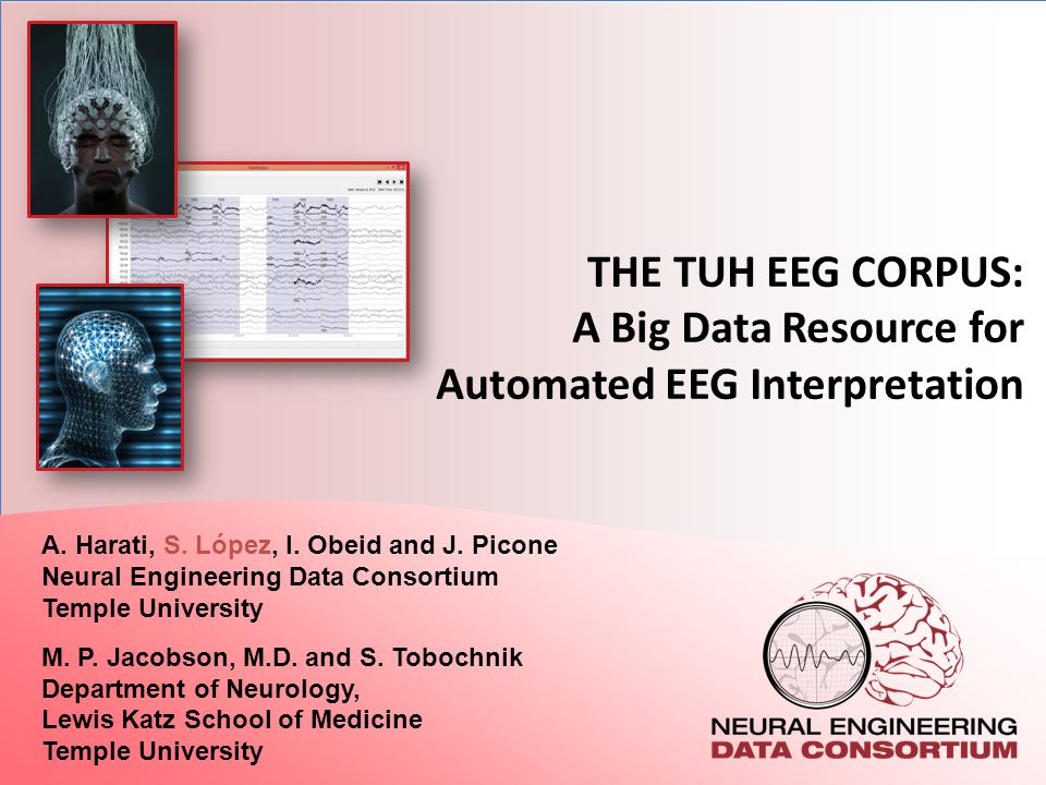 the tuh eeg corpus a big data resource for automated eeg interpretation a harati s lopez i obeid and j picone neural engineering data consortium ppt download