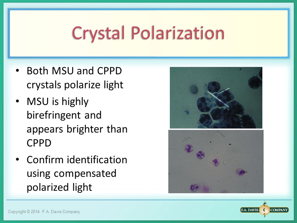 How to make msu crystals