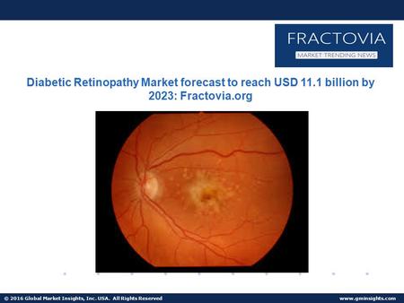 © 2016 Global Market Insights, Inc. USA. All Rights Reserved  Non-Proliferative Diabetic Retinopathy Market size to surpass USD 7.5 billion by 2023
