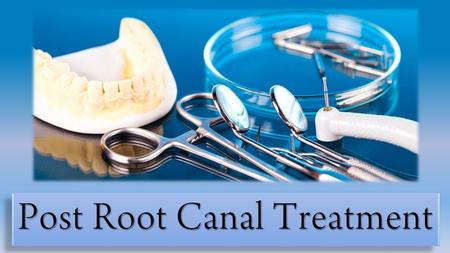 Post Root Canal Treatment