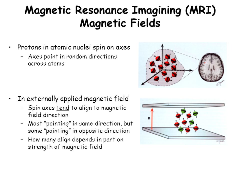 Magnetic Resonance Imagining (MRI) Magnetic Fields Protons in atomic nuclei  spin on axes –Axes point in random directions across atoms In externally  applied. - ppt download