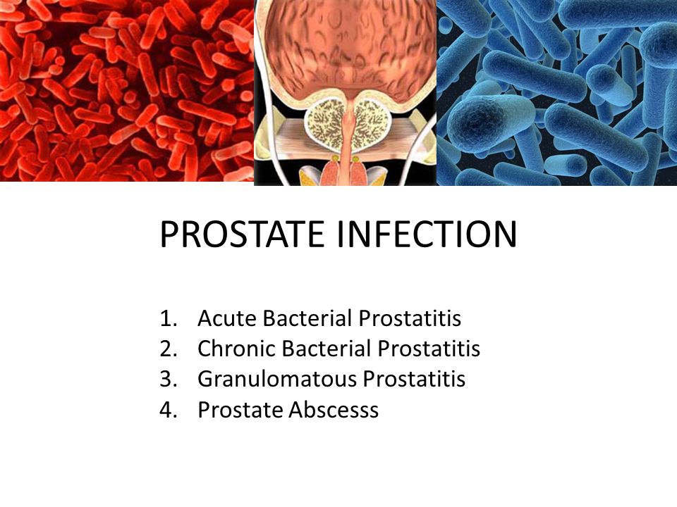 Slid prosztatitis)