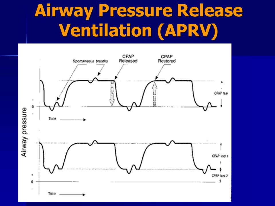 Airway Pressure Release Ventilation (APRV) - ppt download