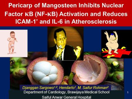 Pericarp of Mangosteen Inhibits Nuclear Factor κ B (NF- κ B) Activation and Reduces ICAM-1 and IL-6 in Atherosclerosis Department of Cardiology, Brawijaya.