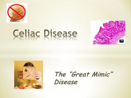 The “Great Mimic” Disease