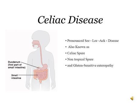 Celiac Disease Pronounced See - Lee -Ack - Disease Also Known as Celiac Spure Non tropical Spure and Gluten-Sensitive enteropathy.
