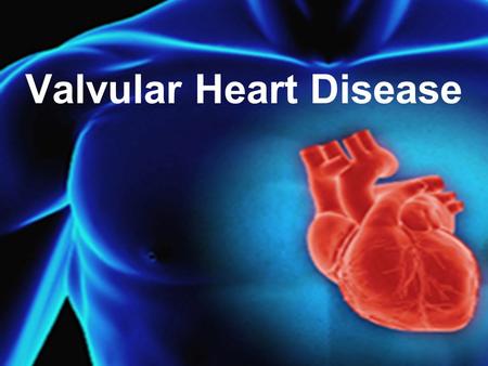 Valvular Heart Disease. physiology Spectrum of VHD Aortic Valve Mitral Valve Tricuspid Valve Pulmonic Valve.