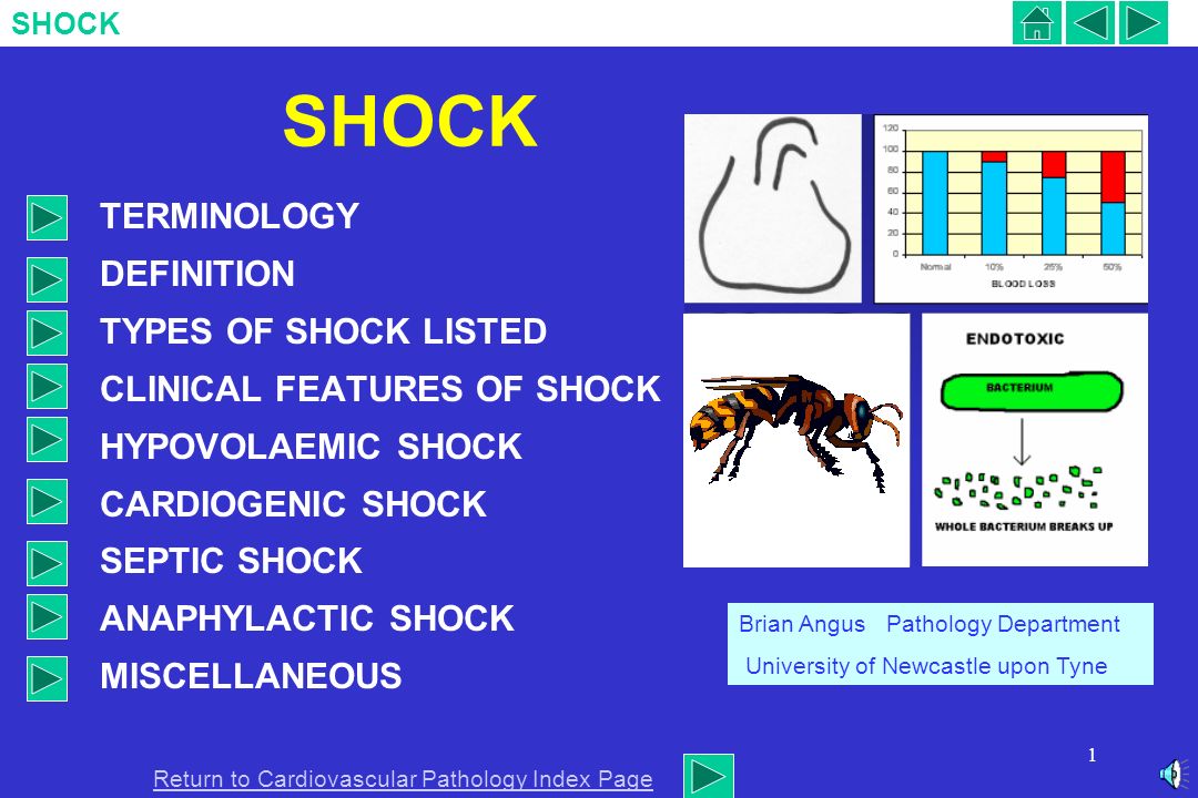 Shock and its description