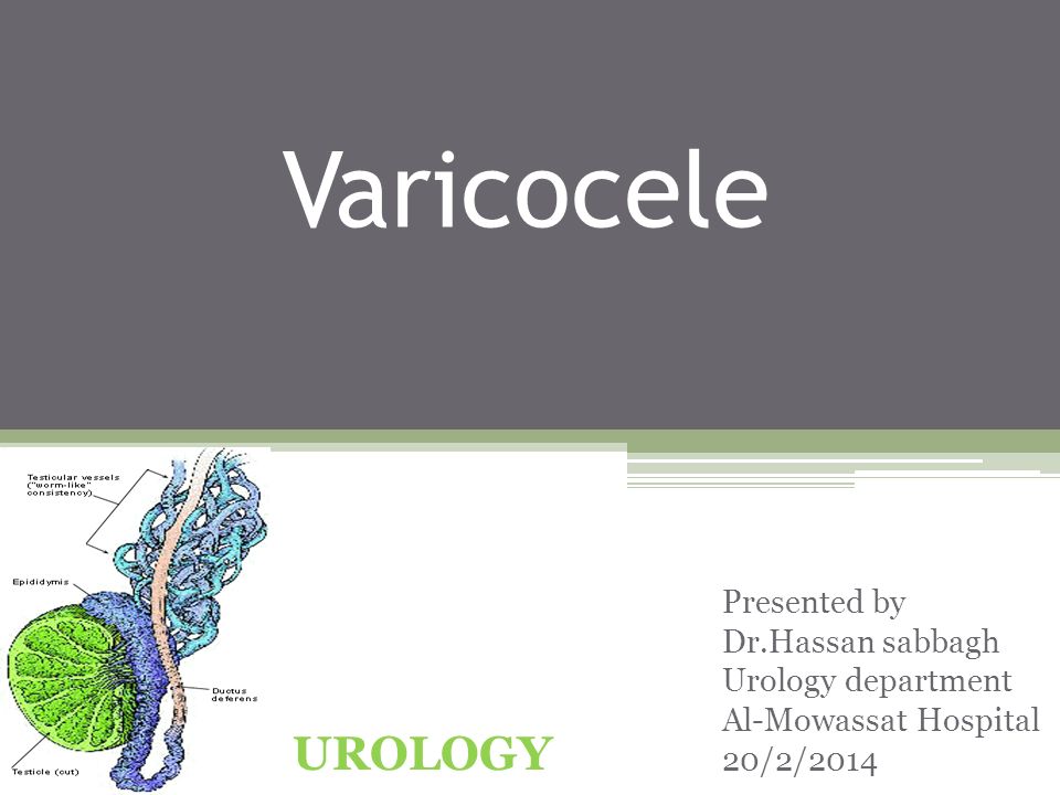Vene varicoase urolog - Urolog varicoz