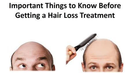 Important Things to Know Before Getting a Hair Loss Treatment