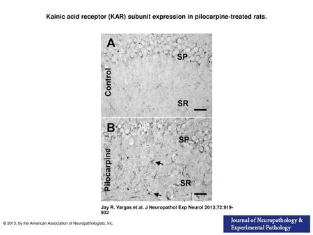 Kainic acid receptor (KAR) subunit expression in pilocarpine-treated rats. Kainic acid receptor (KAR) subunit expression in pilocarpine-treated rats. (A)
