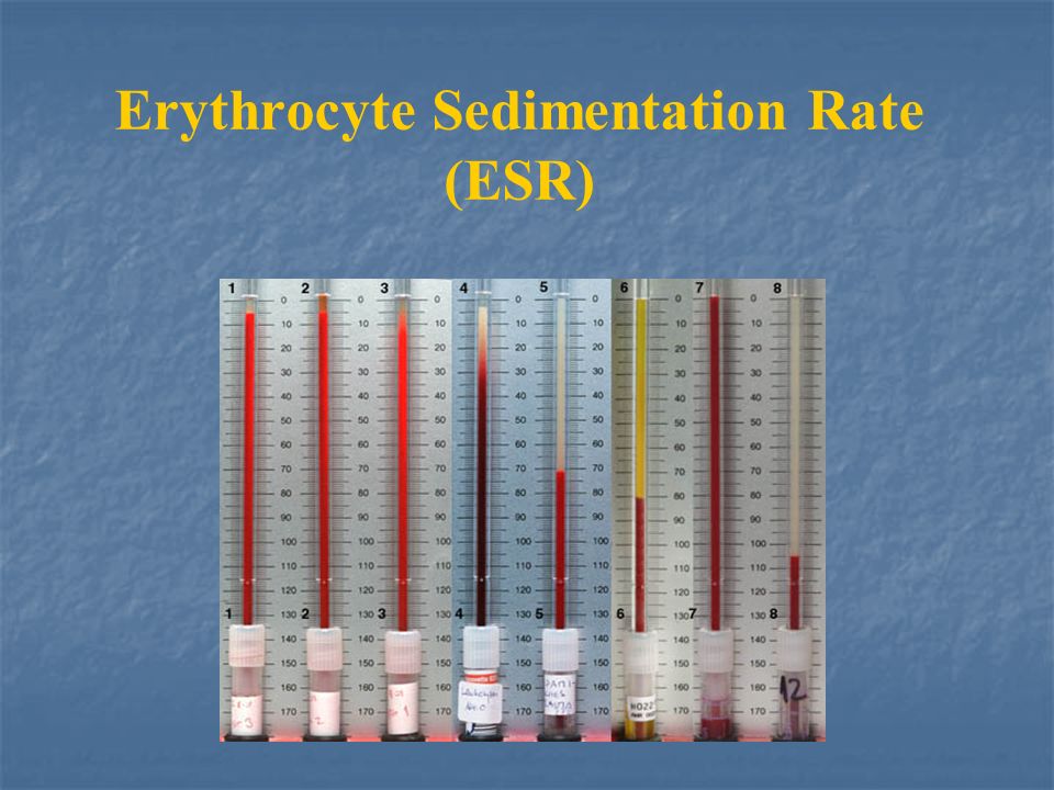 Erythrocyte Sedimentation Rate (ESR) - ppt video online download