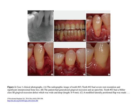 Figure 2. Case 1 clinical photographs