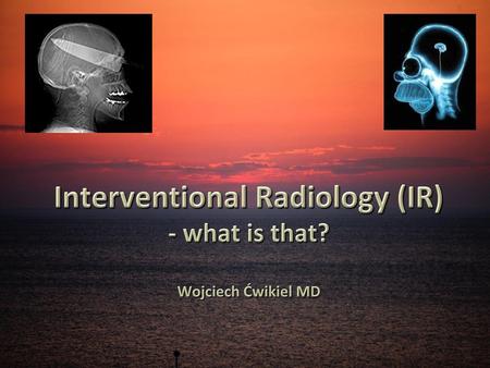 Interventional Radiology (IR) - what is that? Wojciech Ćwikiel MD