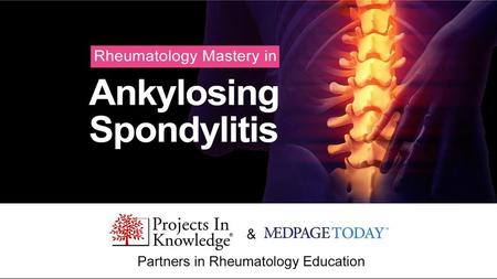 Rheumatology Mastery in Ankylosing Spondylitis
