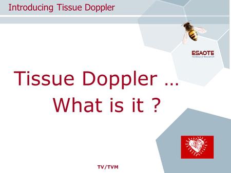 TV/TVM Tissue Doppler … Introducing Tissue Doppler What is it ?