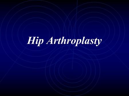 Hip Arthroplasty.