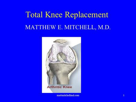 Mattmitchellmd.com1 Total Knee Replacement MATTHEW E. MITCHELL, M.D.