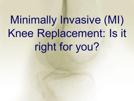 Minimally Invasive (MI) Knee Replacement: Is it right for you?