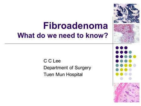 Fibroadenoma What do we need to know?