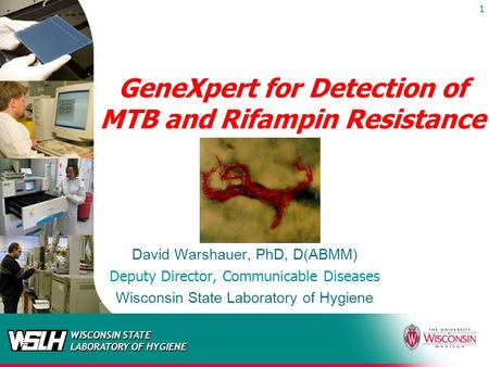 GeneXpert for Detection of MTB and Rifampin Resistance