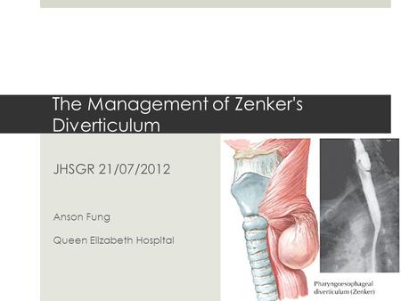The Management of Zenker's Diverticulum