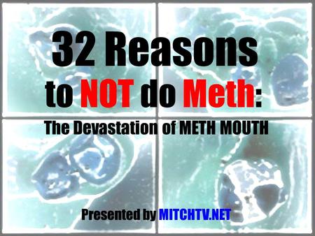 32 Reasons to NOT do Meth: The Devastation of METH MOUTH