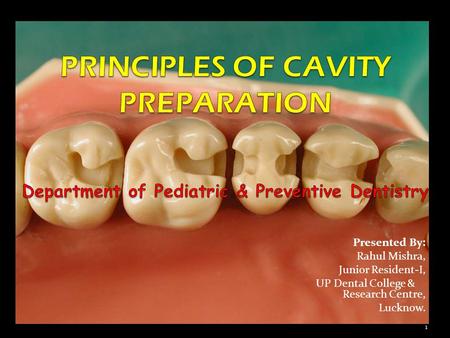 Class II Amalgam Cavity Preparartion - ppt video online download