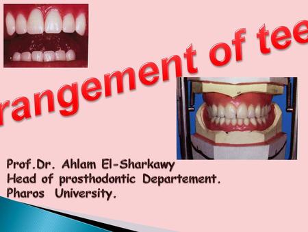 Arrangement of teeth Prof.Dr. Ahlam El-Sharkawy