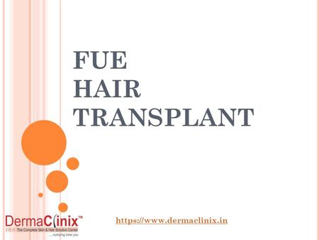 FUE Hair Transplant in Delhi