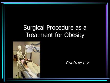 Surgical Procedure as a Treatment for Obesity