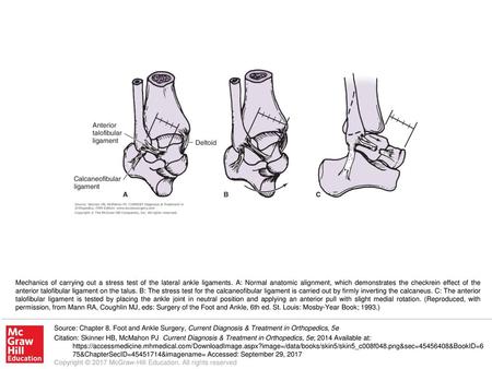 Mechanics of carrying out a stress test of the lateral ankle ligaments